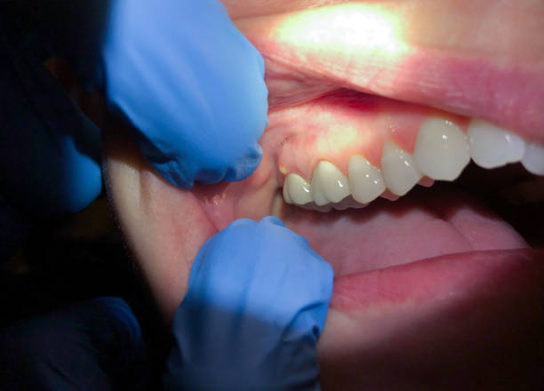 Best Emergency Dental Care for Trauma or Injury in Conroe, TX